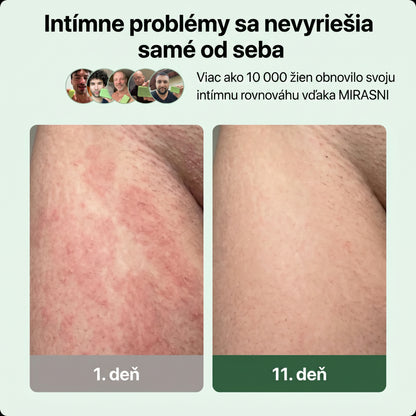 Veloma Antifungálne Mydlo